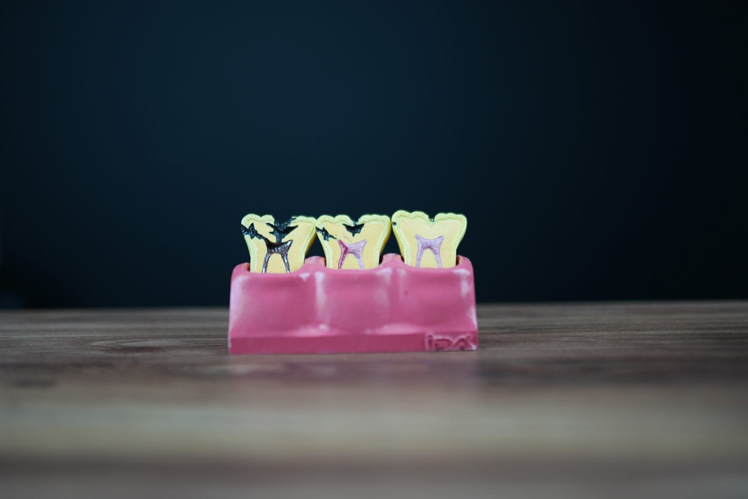 Dental Root Canal Treatment