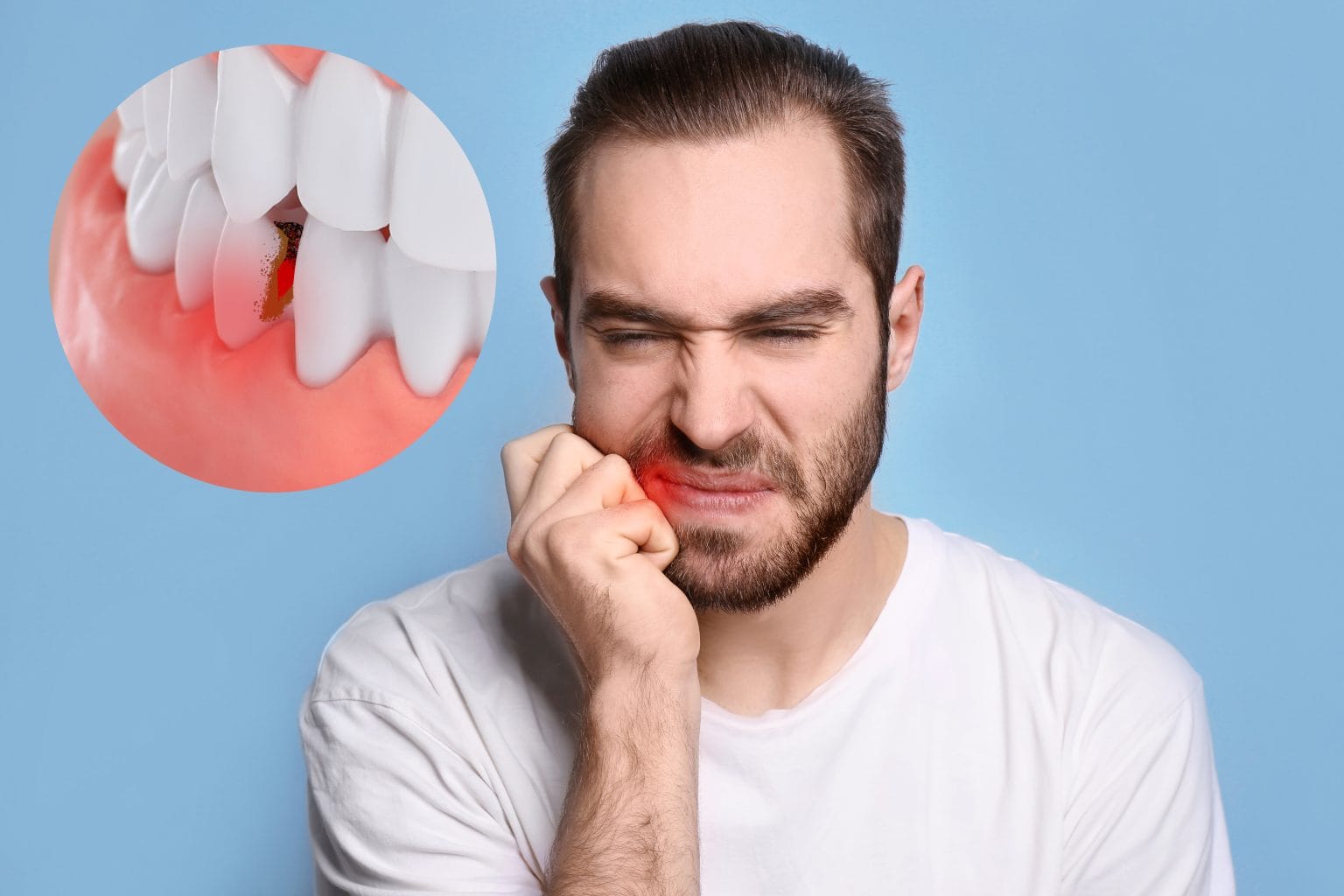 Gum Disease Treatment